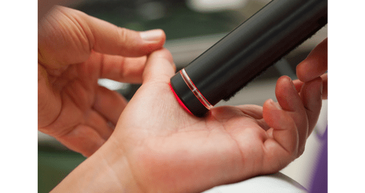 Laser terapia roma balduina